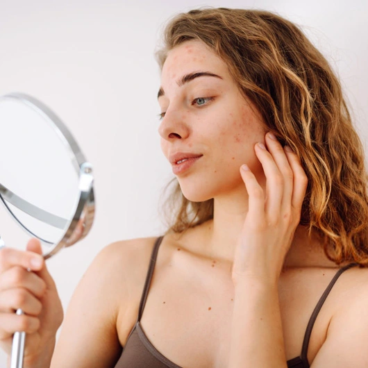 How Long Will it Take to Treat Rosacea? Banner
