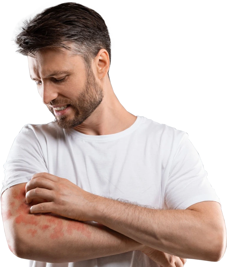Psoriasis Specialist Banner