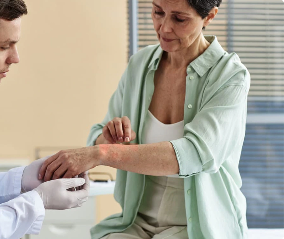 Who Needs Psoriasis Treatment Banner