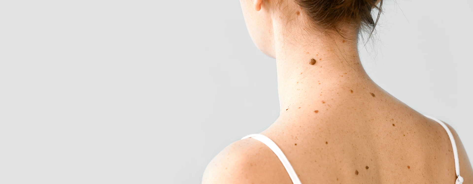 Melanoma Treatment In Fresno, CA Banner