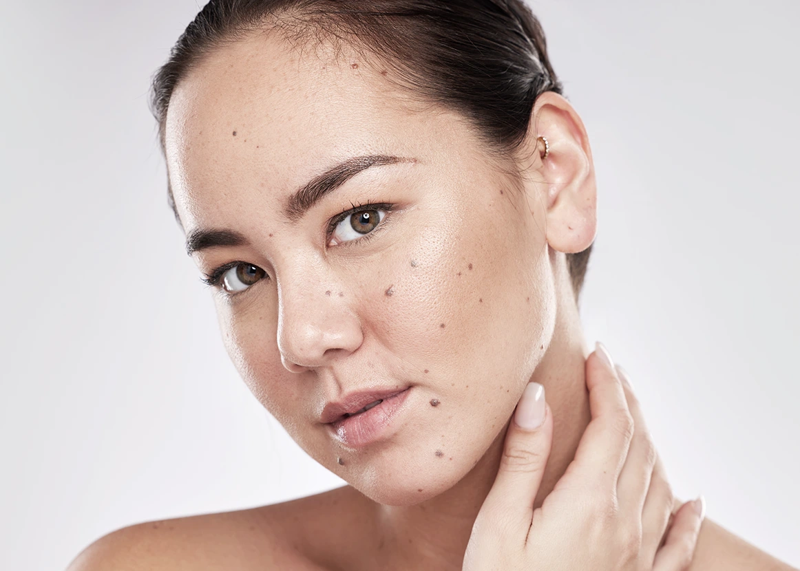 Mole Removal in Fresno, CA Banner