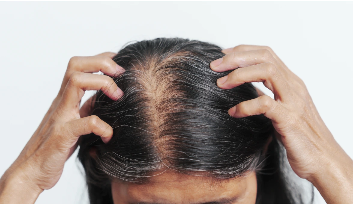 Hair Loss Common Issue Banner