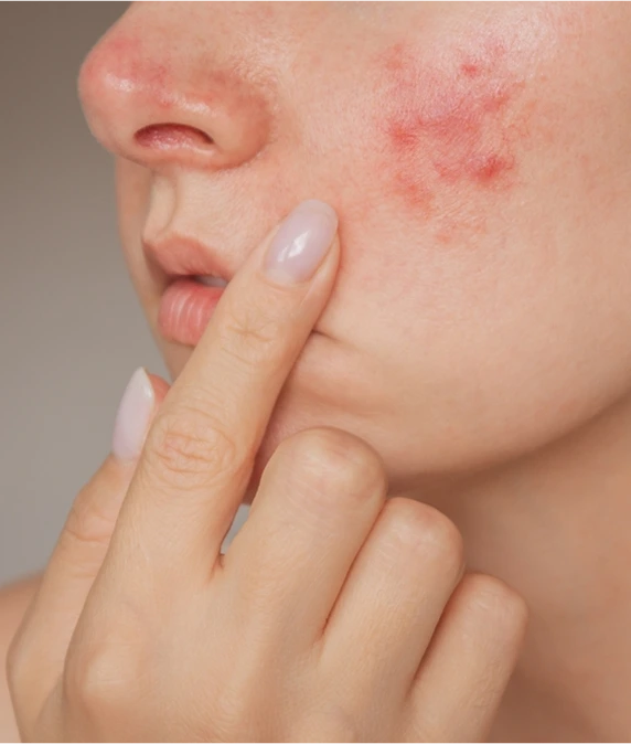 Fresno, CA Dermatitis Treatment: Types of Dermatitis Banner