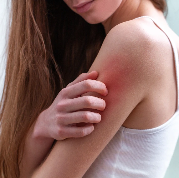 Benefits of Skin Rashes Treatment Banner