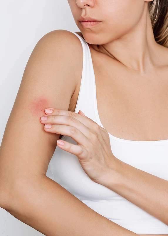 Candidates for Our Skin Rashes Treatments Banner