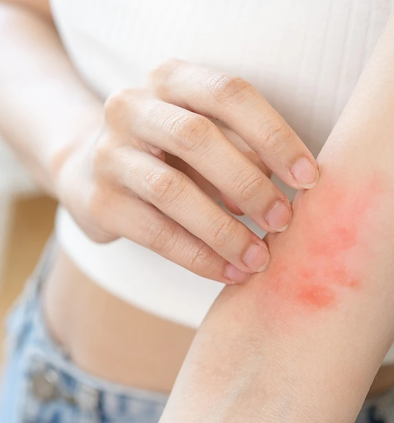 Our Treatment Options for Skin Rashes Banner