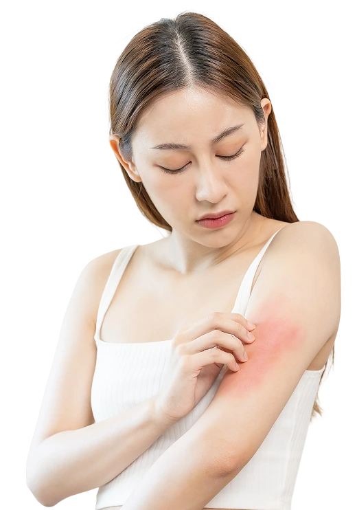 Skin Rashes Treatment in Fresno, CA Batter